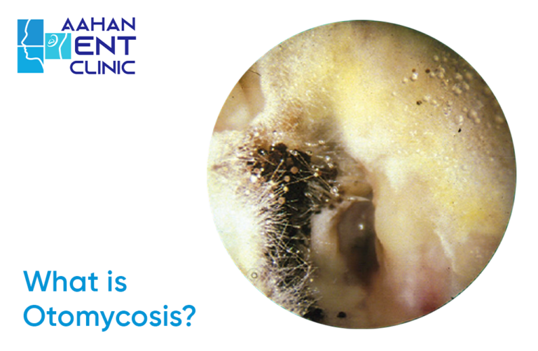 Fungal Infection of the Ear - Aahan ENT Clinic - Dr.Ajay Doiphode