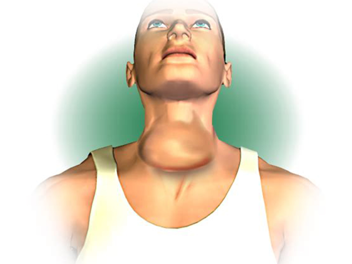 Head & Neck Cancer Aahan ENT Clinic Dr.Ajay Doiphode